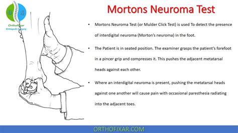 morton's neuroma compression test|morton's neuroma diagnostic tests.